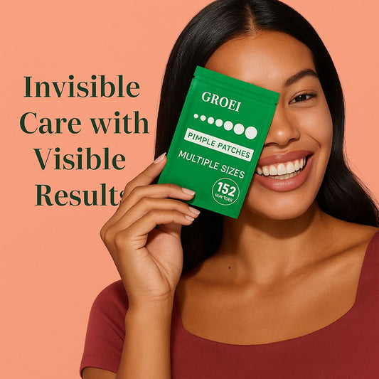UrbanCart™ Hydrocolloid Acne Patch Kit – 152 Multi-Size Pimple Covers (Salicylic Acid + Tea Tree)